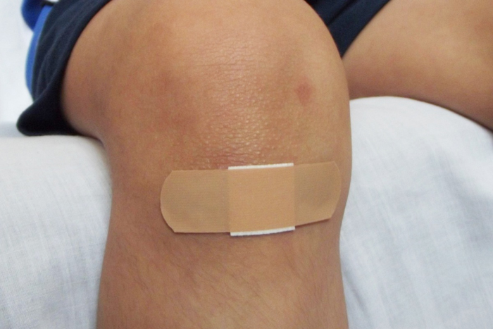 【萊沃醫(yī)療：知識分享】疤痕修復也有黃金時間？身上有疤的要注意啦~